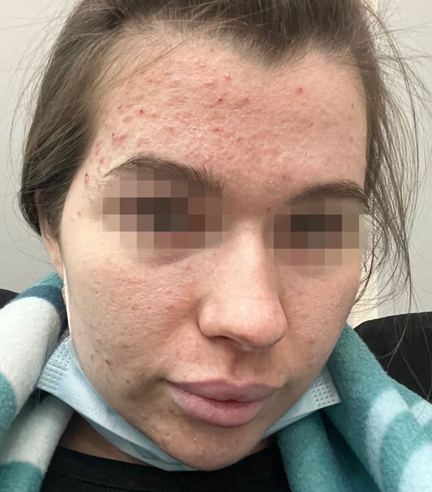 Фото до ухода YUSKISS