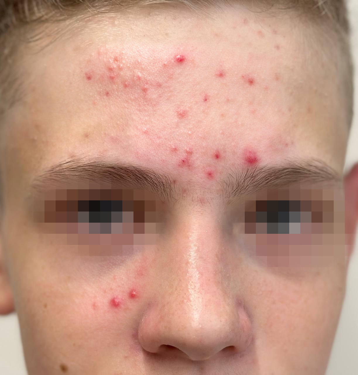 Фото до ухода YUSKISS