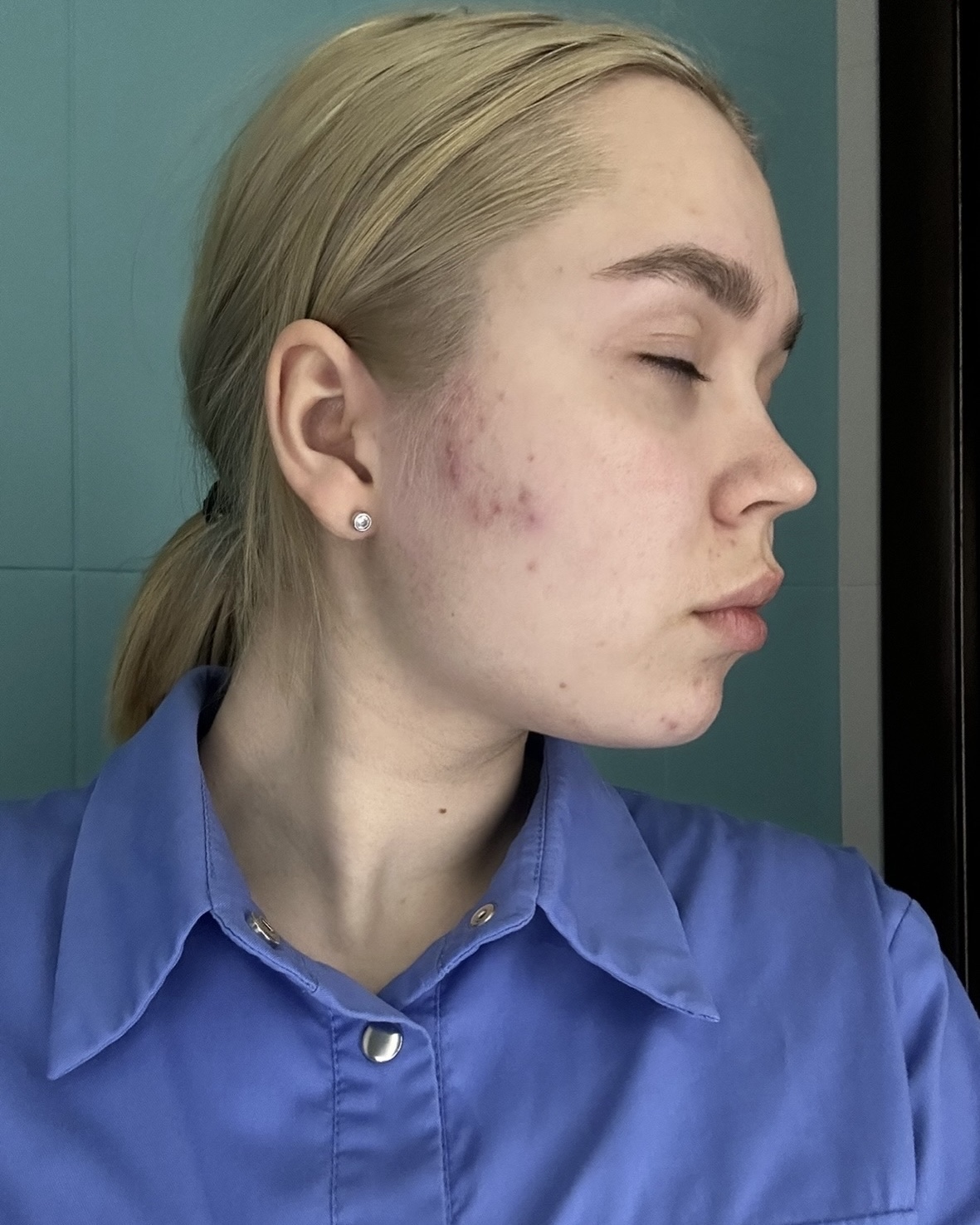 Фото до ухода YUSKISS