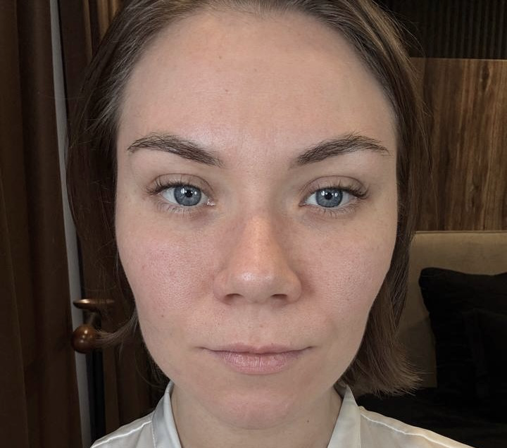 Фото до ухода YUSKISS